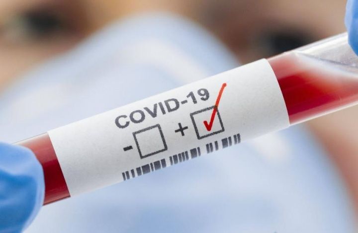 Кому и как часто надо проверяться на коронавирус?