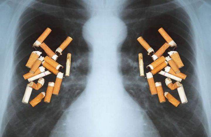 Отказ пациентов от курения снижает частоту обострений ХОБЛ на 50%