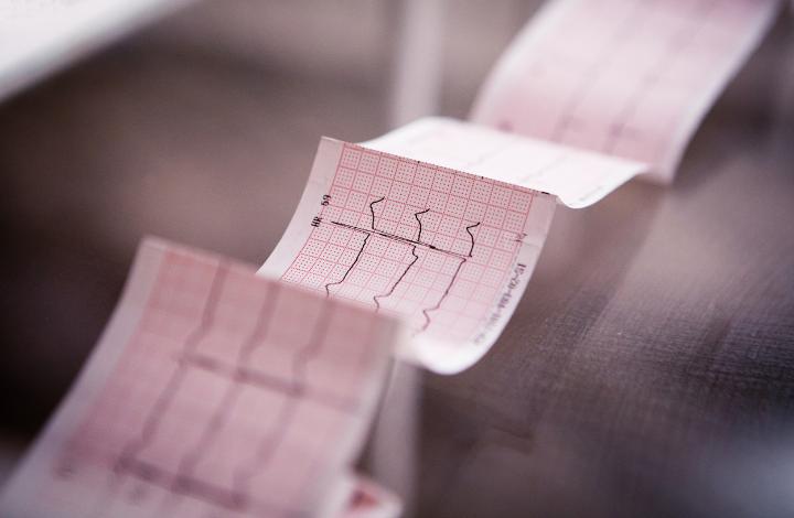 Резидент «Сколково» получил регистрационное удостоверение на телемедицинский кардиограф 