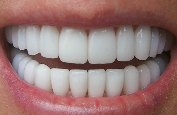 Мировые рекорды: Сколько у человека может быть зубов?