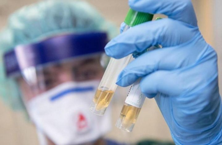 Сеть лабораторий KDL начала делать анализы на коронавирус пациентам столичных клиник, используя высокочувствительные тесты