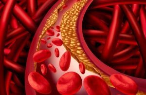 Кровь на холестерин. Что нужно знать об исследовании?