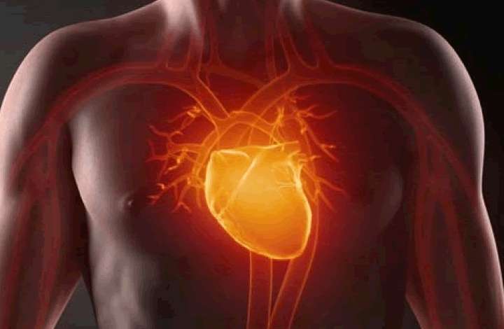 Как возникают инфаркт и инсульт? Рассказывает кардиолог