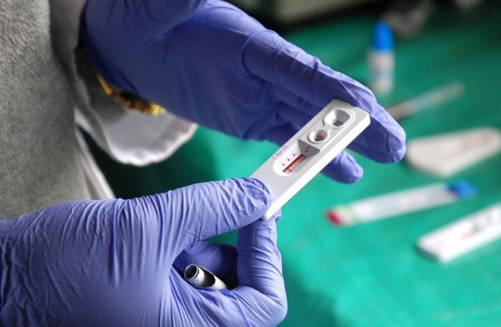 Прививка от ВИЧ показала 100% эффективность. Когда вакцинация?