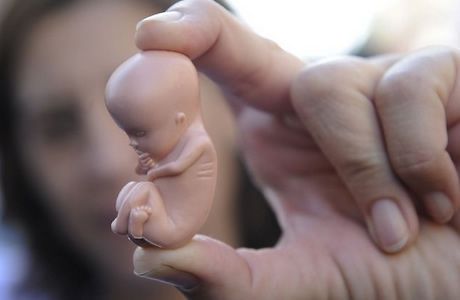 Влияние абортов на демографию в России