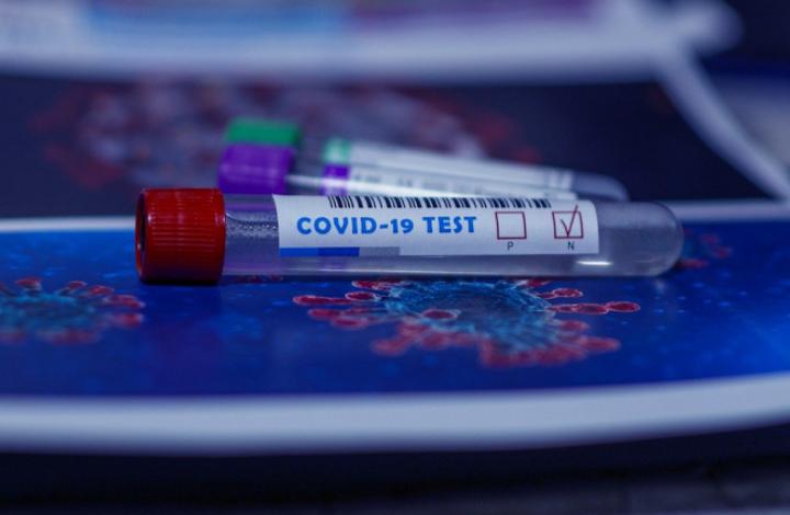 Иммунолог объяснил, зачем сдавать ПЦР-тест на COVID-19 после вакцинации
